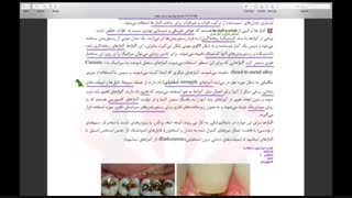 دمو تدریس مواد دندانی دوره اصلی استاد  دکتربیرمرادیان  آمادگی آزمون رزیدنتی(ماهان-نوآوران دانش)