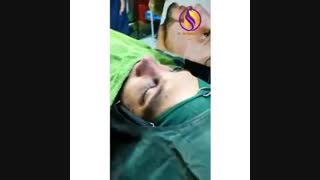 رینوپلاستی مردانه