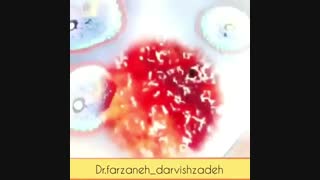 علائم سرطان تخمدان