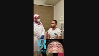 رضایت بیمار و مراجعه بعد از گدشت 3 سال بعد از عمل بینی