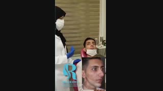 مراجعه بعد از عمل بینی مردانه