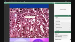 جلسه ی دوم پاتولوژی اختصاصی۲ نظری