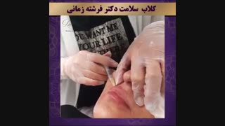 فرم دهی طبیعی لب با متد Dfz