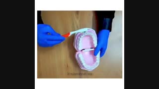 نحوه ی صحیح مسواک زدن