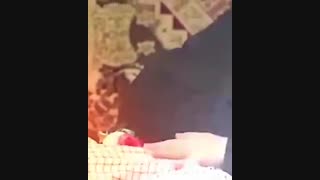 شهید سرافراز(علی عابدینی) رفع غبغب