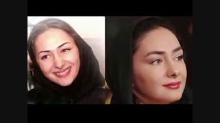 بازیگران زن ایرانی قبل و بعد از عمل زیبایی