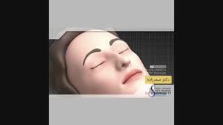 جراحی بینی