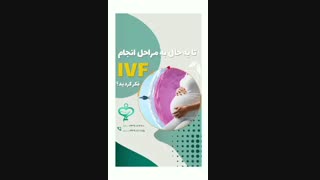 مراحل انجام ivf