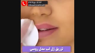 ژل لب مدل روسی 2