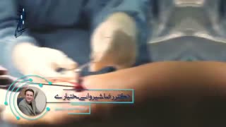 جراحی بازسازی رباط صلیبی زانو (PCL)