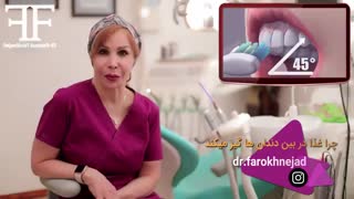 چرا غذا در بین دندان ها گیر می کند