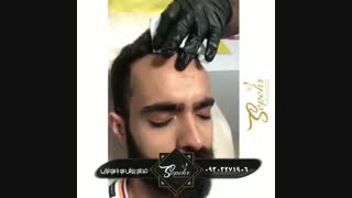 درمان و جلوگیری از ریزش مو با مزوتراپی