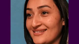 فیلم واقعی جراحی بینی استخوانی بعد از 4 ماه