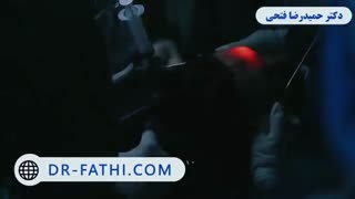 لیفت پیشانی و ابرو با آندوسکوپی