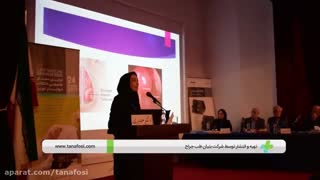 سخنرانی دکتر ریحانه حیدری  متخصص گوش و حلق و  بینی و فلوشیپ اختلالات خواب در اولین سمینار اختلالات خواب