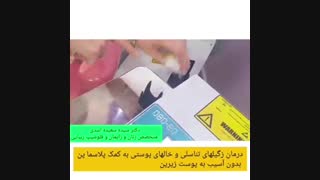درمان عفونت مکرر واژن