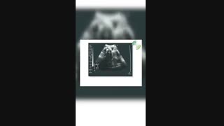 فیلم سونوگرافی دوران بارداری با توضیحات دکتر جورابیان