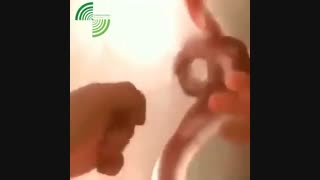 فیلم واقعی جنین در رحم مادر