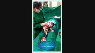 فیلم زایمان سزارین