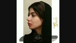 نمونه زیبای تزریق ژل