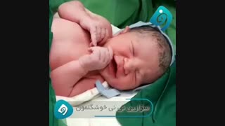 زایمان سزارین توسط دکتر فاطمه فیروزی رفع افتادگی پلک