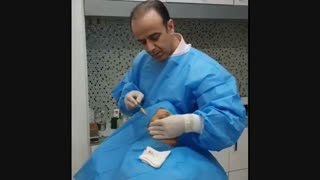 فیلم تزریق چربی جهت جوانسازی و حجم دهی صورت