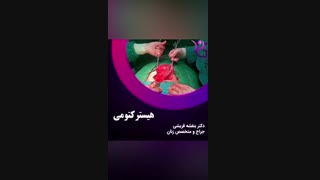 عمل برداشتن رحم یا هیسترکتومی