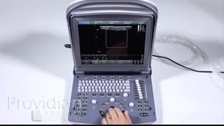 دستگاه سونوگرافی رنگی Chison ECO5