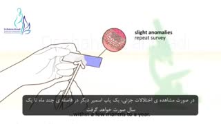 فیلم تست پاپ اسمیر