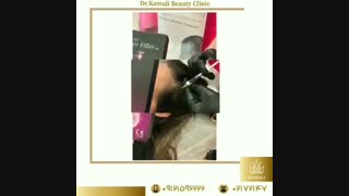 فیلم واقعی افزایش تراکم مو