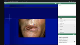جلسه ی هفتم پاتولوژی اختصاصی۲ نظری