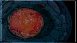 نقاشی با رزین اپوکسی-  نقاشی آبستره عروس دریایی سه بعدی