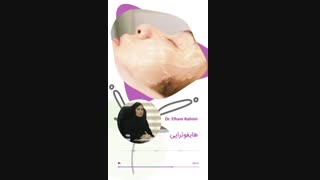 همه چیز در مورد هایفو