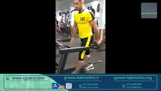 ساخت پروتز پا در کلینیک حکیم