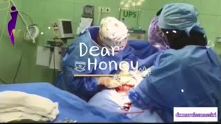 زایمان پسر گلمون به روش سزارین