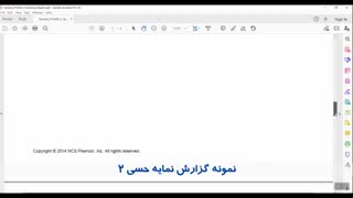 نمایه حسی ۲ (Sensory Profile  2)