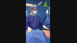 فیلم عمل ژنیکوماستی