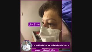 جراحی زیبایی پلک و لیفت ابرو