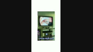 فیلم لیفت اندوسکوپیک پیشانی مزوتراپی