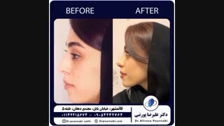 دکتر علیرضا پورنبی-Drpournabi (@drpournabi_omfs) • Instagram photos and videos_3