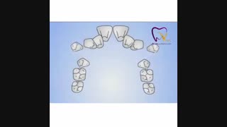 نحوه انجام ارتودنسی