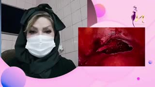 توضیحاتی در مورد سرکلاژ