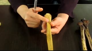 عملی استخوان اولنا و رادیوس