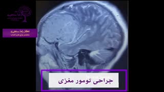 فیلم واقعی جراحی تومور مغزی