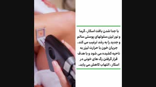 هر آنچه باید درباره لیزر جای زخم بدانید