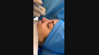 بلافاصله بعد از عم بینی