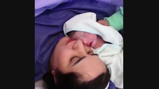 عمل جراحی سزارین