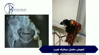 دقت بالای آرتروسکوپی