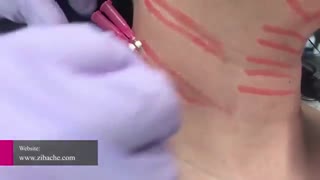 جاگذاری نخ PDO برای خطوط گردن