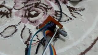 سجاد کریم نژاد دندان پیش
